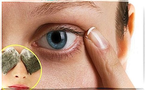 5 remedies for dark circles under the eyes