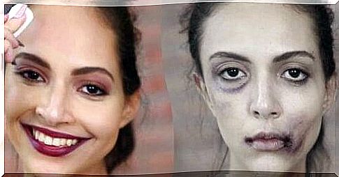 Some women increase to hide marks from blows with makeup