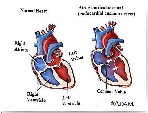 7 symptoms of heart murmurs you should know!