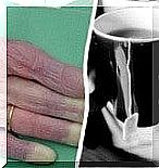 Cold hands: Possible causes you should know