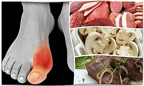 Do you suffer from arthritis?  Avoid these 7 foods