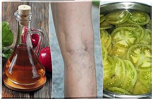 Fight varicose veins with vinegar and green tomatoes