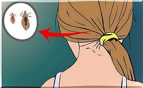 Get rid of lice the natural way