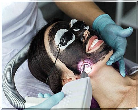 Laser treatment with activated carbon: Process and care