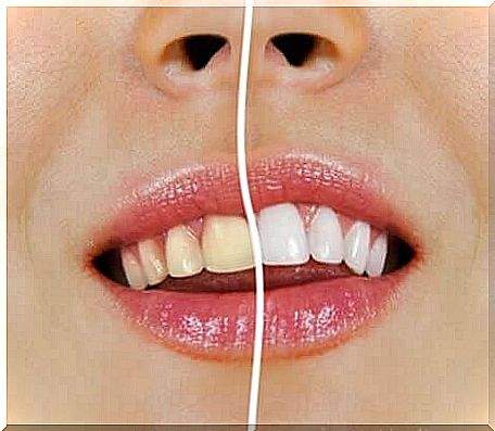 Natural products for whitening teeth