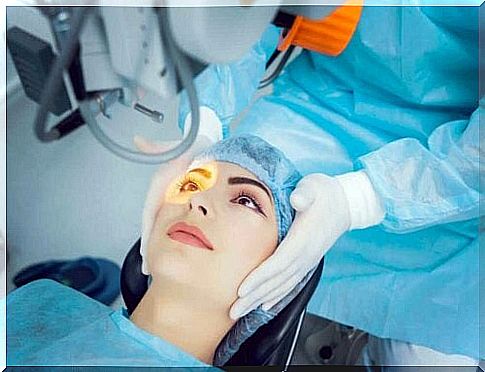 Laser surgery of the eye to treat open-angle glaucoma