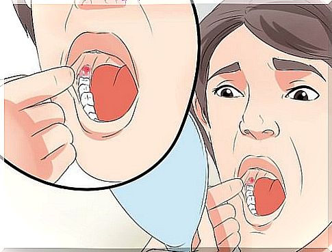 Reduce swelling after removing wisdom teeth