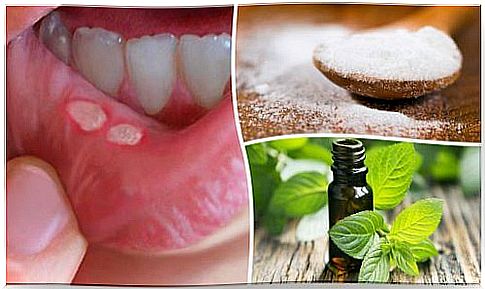 Seven home remedies for mouth sores