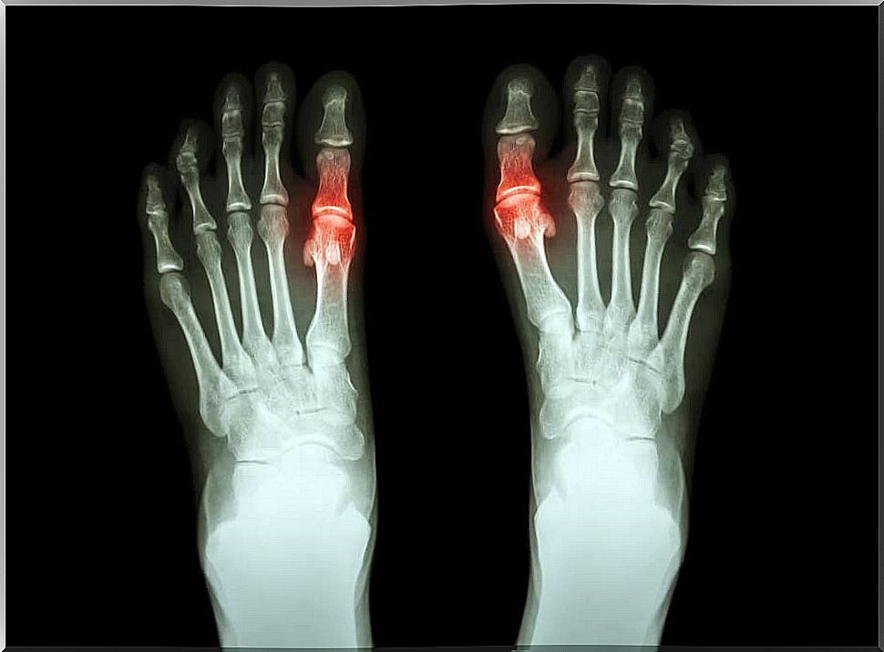 Tips to relieve foot pain at home