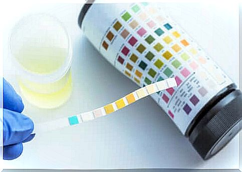 What can you see in a urine sample?