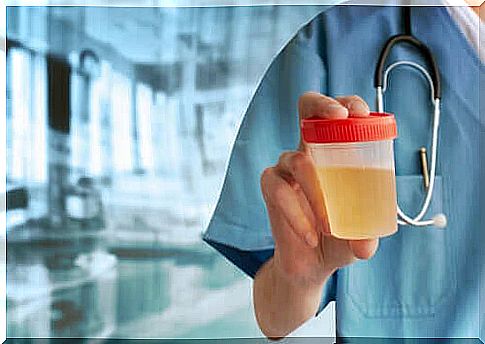 Doctor stands with a urine sample