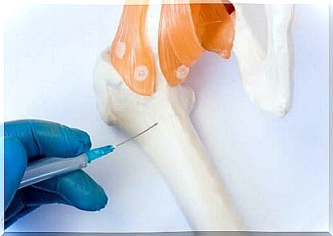 Bone marrow is extracted with a needle