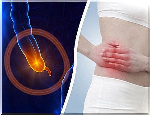 What is appendicitis and what causes it?