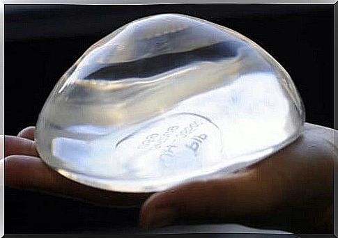 Breast implants